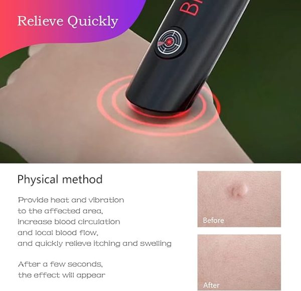 Mosquito Bite Helper – Insect Bite Relief, Useful For Summer, Helps Children, Insect Bites, Adults, Irritation, Itching, Neutralizer, Relieve Stings (cell Operated)